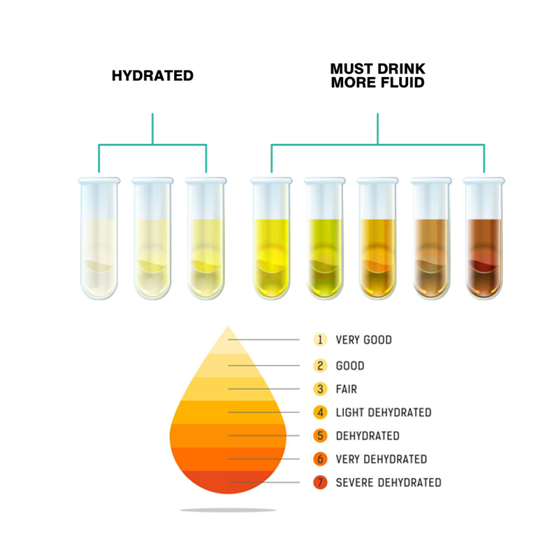urine-analysis