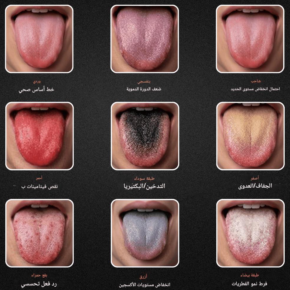 tongue-diagnosis