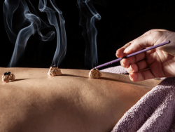 دبلوم العلاج بالكي الصيني (موكسا) Moxibustion دبلوم العلاج بالكي الصيني (موكسا) Moxibustion